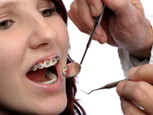 dépistage orthodontique
