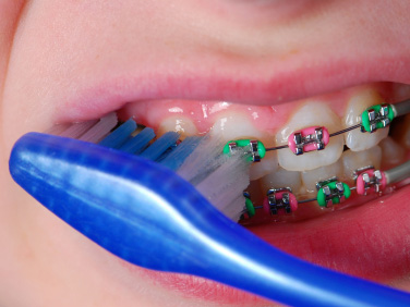 orthodontie